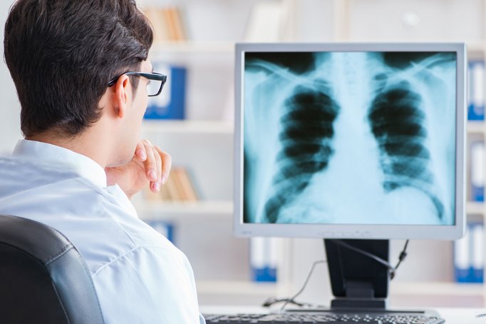 Röntgenbild Lunge