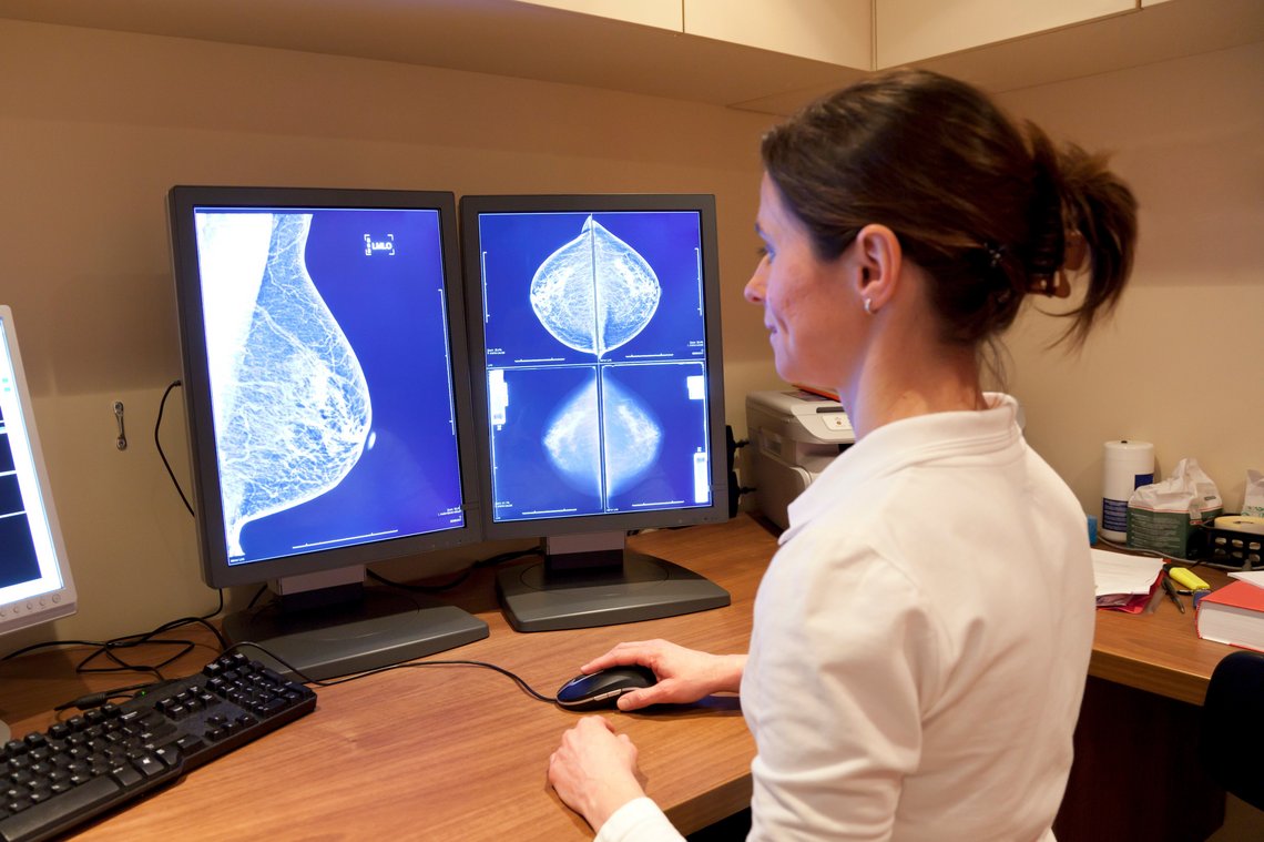 Mammographie Aufnahmen