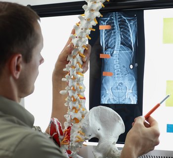 Skoliose der Wirbelsäule auf Röntgenbild